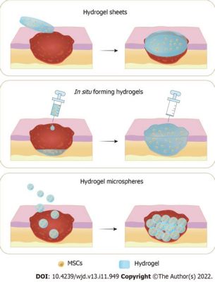  Iodine-Infused Hydrogel:Revolutionizing Wound Healing and Drug Delivery Applications!